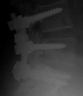 Dre's surgery 2 - 1 of 2