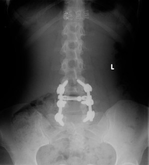 Dre's surgery 2 - 2 of 2